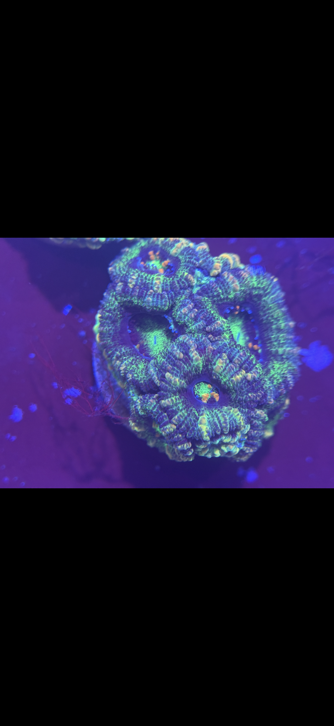 Acan