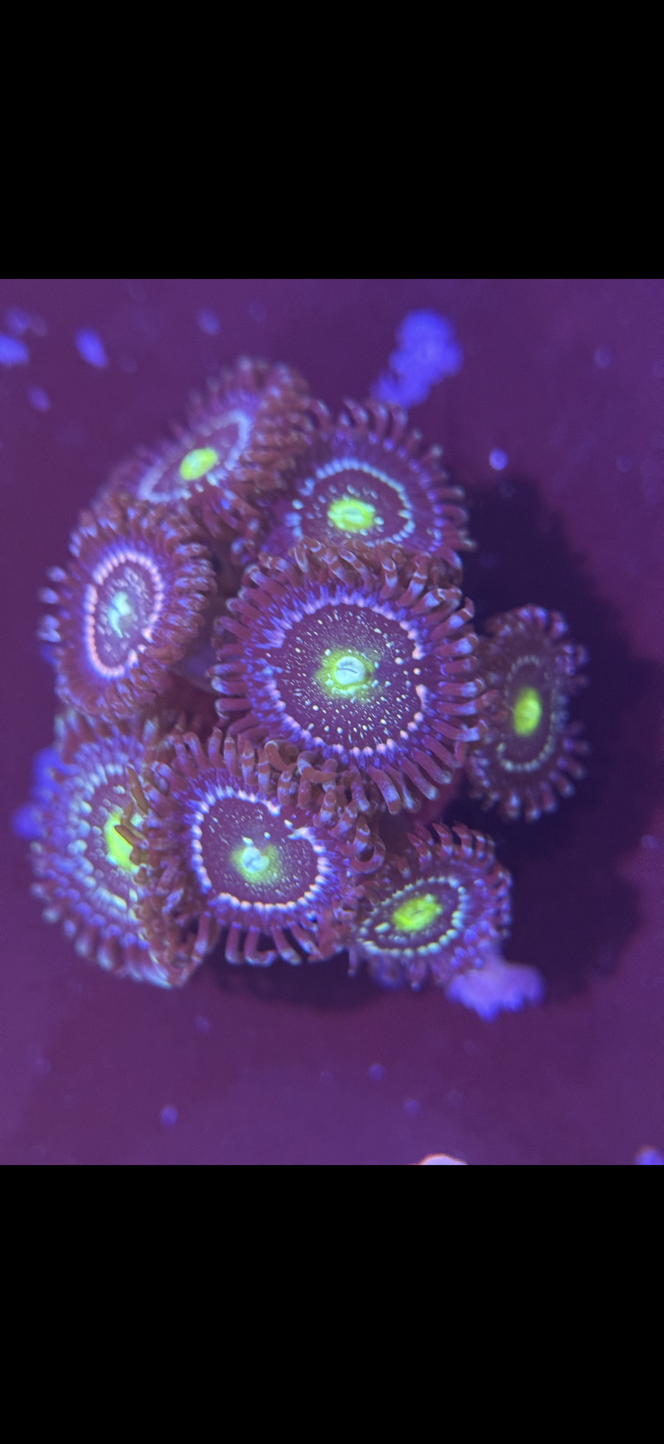 Zoa